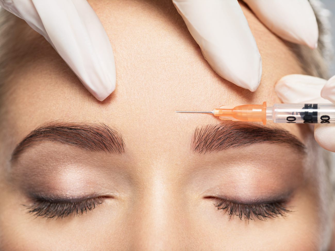 Botox mot rynkor, migrän, och svettningar – JL Medical i Linköping